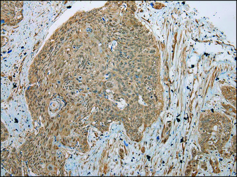 Anti-TBCA affinity isolated antibody