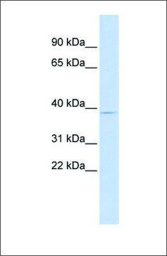 Anti-PITX3 antibody produced in rabbit affinity isolated antibody