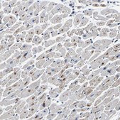 Anti-PDLIM7 antibody produced in rabbit Prestige Antibodies® Powered by Atlas Antibodies, affinity isolated antibody, buffered aqueous glycerol solution