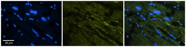 Anti-SCN5A (C-terminal) antibody produced in rabbit affinity isolated antibody