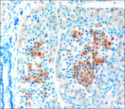 Anti-LRP5 antibody produced in goat affinity isolated antibody, buffered aqueous solution