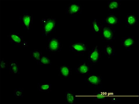 Monoclonal Anti-ZFYVE19 antibody produced in mouse clone 4D5-2D11, purified immunoglobulin, buffered aqueous solution