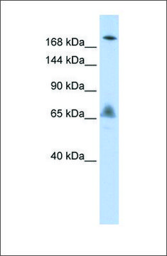 Anti-VPS8 antibody produced in rabbit affinity isolated antibody