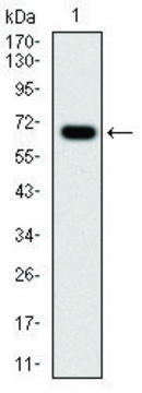 Monoclonal Anti-G6PD antibody produced in mouse clone 5E12, ascites fluid