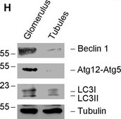 Anti-&#945;-Tubulin antibody, Mouse monoclonal clone B-5-1-2, purified from hybridoma cell culture