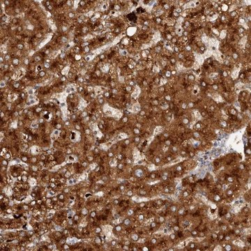 Anti-AGL antibody produced in rabbit Prestige Antibodies&#174; Powered by Atlas Antibodies, affinity isolated antibody, buffered aqueous glycerol solution