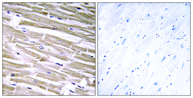 Anti-B3GALT2 antibody produced in rabbit affinity isolated antibody