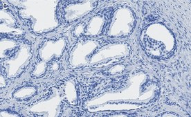 Anti-TMPRSS2 Antibody, clone 1B20 ZooMAb® Rabbit Monoclonal recombinant, expressed in HEK 293 cells