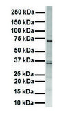 Anti-RHOT1 (ab1) antibody produced in rabbit affinity isolated antibody