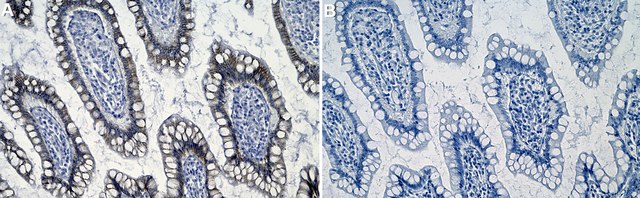 Anti-Catenin &#945;-1 Antibody, clone 1D15 ZooMAb&#174; Rabbit Monoclonal recombinant, expressed in HEK 293 cells