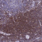 Anti-SPN antibody produced in rabbit Prestige Antibodies® Powered by Atlas Antibodies, affinity isolated antibody, buffered aqueous glycerol solution