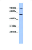 Anti-FOXC1, (N-terminal) antibody produced in rabbit affinity isolated antibody