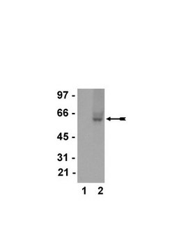 Anti-Calmodulin Binding Protein Epitope Tag Antibody, clone C16T, rabbit monoclonal clone C16T, Upstate&#174;, from rabbit