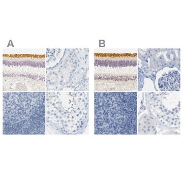 Anti-OPN1SW antibody produced in rabbit Prestige Antibodies&#174; Powered by Atlas Antibodies, affinity isolated antibody