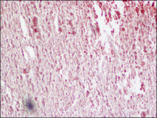 Anti-MR−Pro ADM (Internal) antibody produced in rabbit affinity isolated antibody