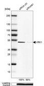 Anti-VRK1 antibody produced in rabbit Prestige Antibodies® Powered by Atlas Antibodies, affinity isolated antibody, buffered aqueous glycerol solution
