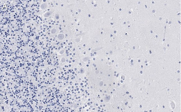 Anti-Aldolase C Antibody, clone 3B18, ZooMAb&#174; Rabbit Monoclonal recombinant, expressed in HEK 293 cells