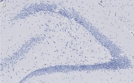 Anti-C9ORF72 (long form) Antibody, clone 1I9 ZooMAb® Rabbit Monoclonal recombinant, expressed in HEK 293 cells