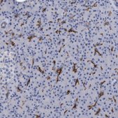Anti-SLC28A3 antibody produced in rabbit Prestige Antibodies® Powered by Atlas Antibodies, affinity isolated antibody, buffered aqueous glycerol solution, Ab1
