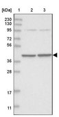 Anti-SEPHS1 antibody produced in rabbit Prestige Antibodies® Powered by Atlas Antibodies, affinity isolated antibody, buffered aqueous glycerol solution