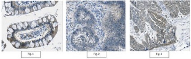 Anti-IDH1/2 Mutant (R132/172) Antibody, clone MsMab-1 clone MsMAb-1, from mouse