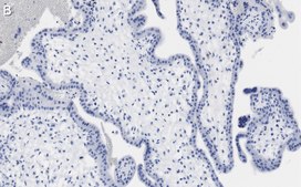 Anti-LAMP-1 Antibody, clone 2E9 ZooMAb® Rabbit Monoclonal recombinant, expressed in HEK 293 cells