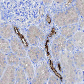Anti-ATP12A antibody produced in rabbit Prestige Antibodies® Powered by Atlas Antibodies, affinity isolated antibody, buffered aqueous glycerol solution