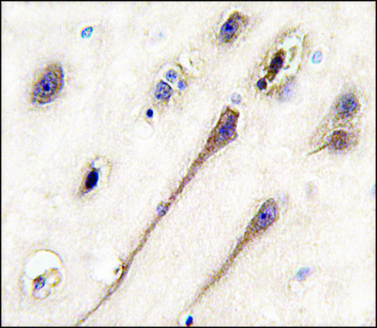 Anti-CYP27C1 (center) antibody produced in rabbit saturated ammonium sulfate (SAS) precipitated, buffered aqueous solution