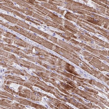 Anti-MT-ND4 antibody produced in rabbit Prestige Antibodies&#174; Powered by Atlas Antibodies, affinity isolated antibody, buffered aqueous glycerol solution