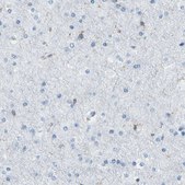 Anti-ARHGAP45 antibody produced in rabbit Prestige Antibodies® Powered by Atlas Antibodies, affinity isolated antibody, buffered aqueous glycerol solution
