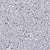 Anti-SLC2A9 antibody produced in rabbit Prestige Antibodies® Powered by Atlas Antibodies, affinity isolated antibody, buffered aqueous glycerol solution
