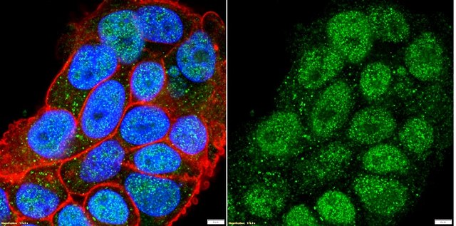 Anti-Estrogen Receptor &#945; Antibody from rabbit, purified by affinity chromatography