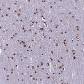 Anti-MPHOSPH8 antibody produced in rabbit Prestige Antibodies® Powered by Atlas Antibodies, affinity isolated antibody, buffered aqueous glycerol solution