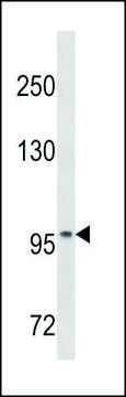 ANTI-OTUD7A (N-TERM) antibody produced in rabbit IgG fraction of antiserum, buffered aqueous solution