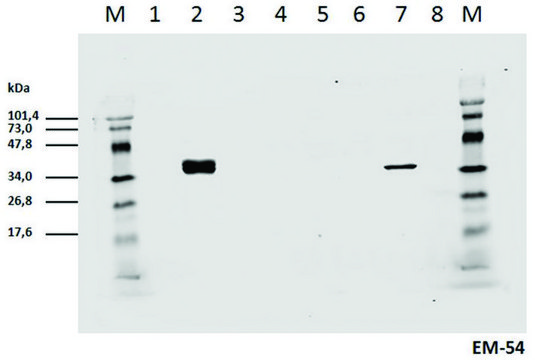 Monoclonal Anti-CD3 zeta (PhosphoTyr142) antibody produced in mouse clone EM-54