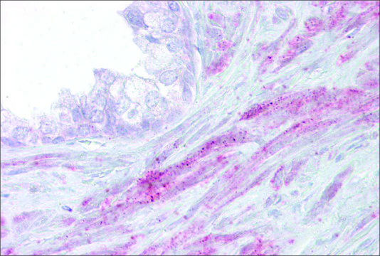 Anti-TRPM8, (N-terminal) antibody produced in rabbit affinity isolated antibody