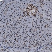 Anti-PHF2 antibody produced in rabbit Prestige Antibodies® Powered by Atlas Antibodies, affinity isolated antibody, buffered aqueous glycerol solution