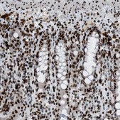 Anti-NUMA1 antibody produced in rabbit Prestige Antibodies® Powered by Atlas Antibodies, affinity isolated antibody, buffered aqueous glycerol solution, Ab1