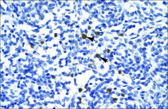 Anti-TAL1 (AB2) antibody produced in rabbit affinity isolated antibody