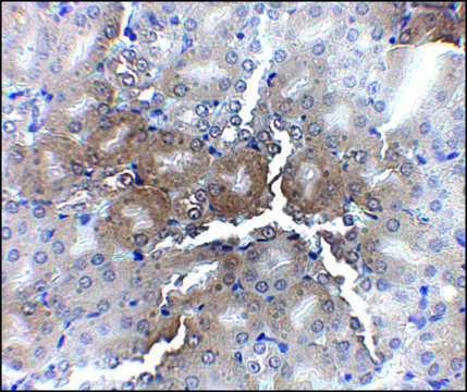 Anti-AP2M1 antibody produced in chicken affinity isolated antibody, buffered aqueous solution