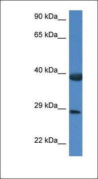 Anti-HSPBP1 antibody produced in rabbit affinity isolated antibody