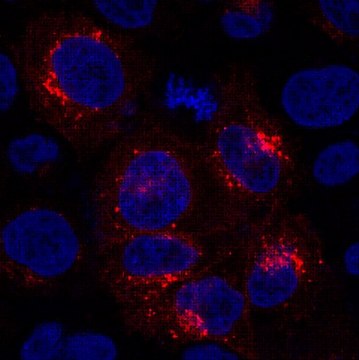 Anti-GPR177 Antibody, clone YJ5 clone YJ5, from mouse