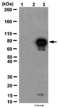 乙酰化p53（Lys320）抗体 from rabbit, purified by affinity chromatography