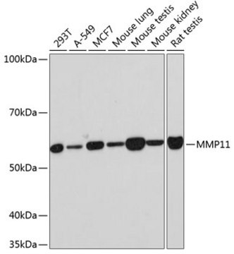 Anti-MMP11 Antibody, clone 8N9D3, Rabbit Monoclonal