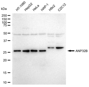 KD-Validated Anti ANP32B Antibody, clone 23GB3650, Rabbit Monoclonal clone 23GB3650, recombinant rabbit monoclonal, expressed in HEK293 cells