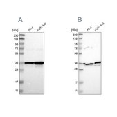 Anti-ANXA1 antibody produced in rabbit Prestige Antibodies® Powered by Atlas Antibodies, affinity isolated antibody, buffered aqueous glycerol solution