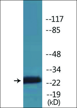 Anti-phospho-CKII-&#946; (pSer209) antibody produced in rabbit affinity isolated antibody