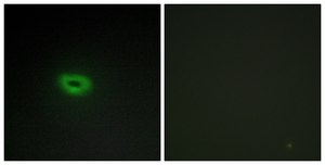 Anti-ECRG4 antibody produced in rabbit affinity isolated antibody