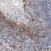Anti-FGFBP1 antibody produced in rabbit Prestige Antibodies® Powered by Atlas Antibodies, affinity isolated antibody, buffered aqueous glycerol solution
