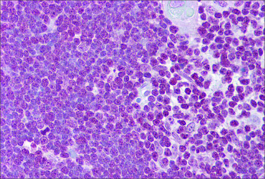 Anti-CD40LG antibody produced in rabbit affinity isolated antibody